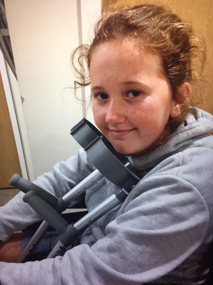 Lauren was diagnosed with SUFE